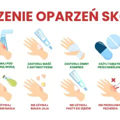 Domowe sposoby na oparzenia po spawaniu: chłodna woda, maść z antybiotykiem, zimny kompres, aloes. Unikaj masła, jajek, pasty do zębów, lodu.