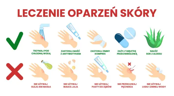 Domowe sposoby na oparzenia po spawaniu: chłodna woda, maść z antybiotykiem, zimny kompres, aloes. Unikaj masła, jajek, pasty do zębów, lodu.