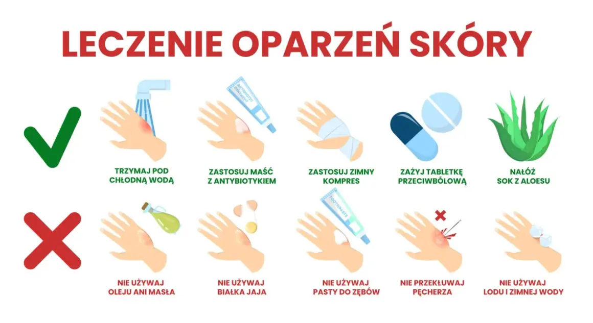 Domowe sposoby na oparzenia po spawaniu: chłodna woda, maść z antybiotykiem, zimny kompres, aloes. Unikaj masła, jajek, pasty do zębów, lodu.