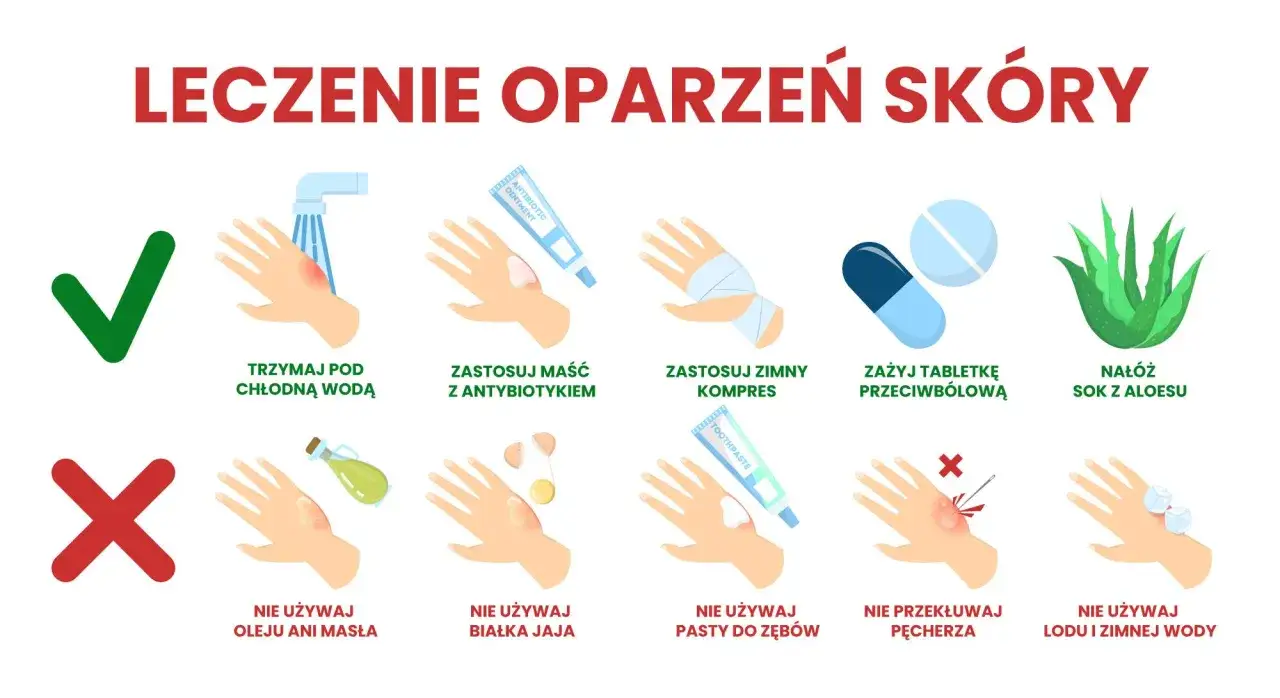 Domowe sposoby na oparzenia po spawaniu: chłodna woda, maść z antybiotykiem, zimny kompres, aloes. Unikaj masła, jajek, pasty do zęb&oacute;w, lodu.